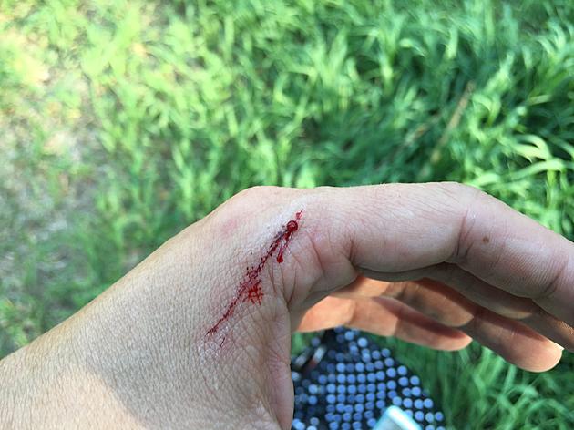 The Injuries of Archery, Bow Season Around the Corner