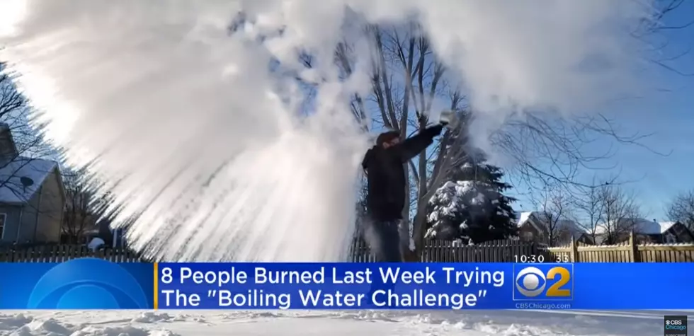 People Are Getting Injured Trying The Boiling Water Challenge