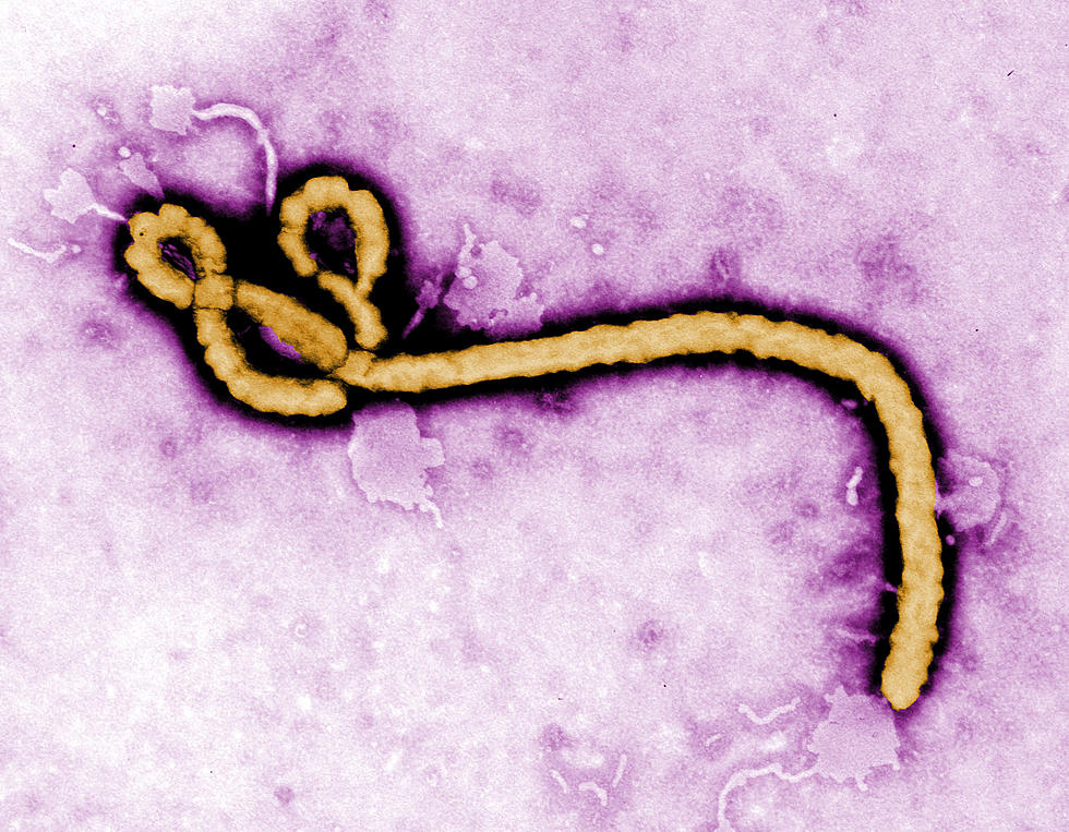 CDC: First Diagnosed Case of Ebola in the U.S.