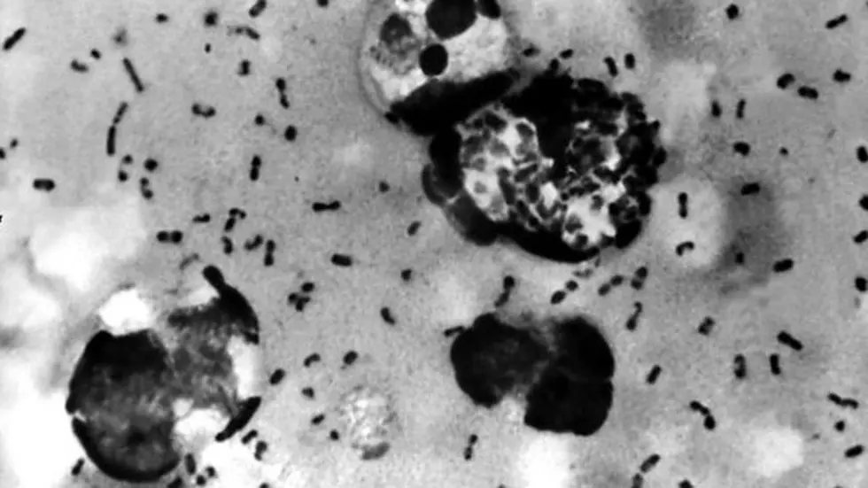 Bubonic Plague Confirmed in Oregon Teen