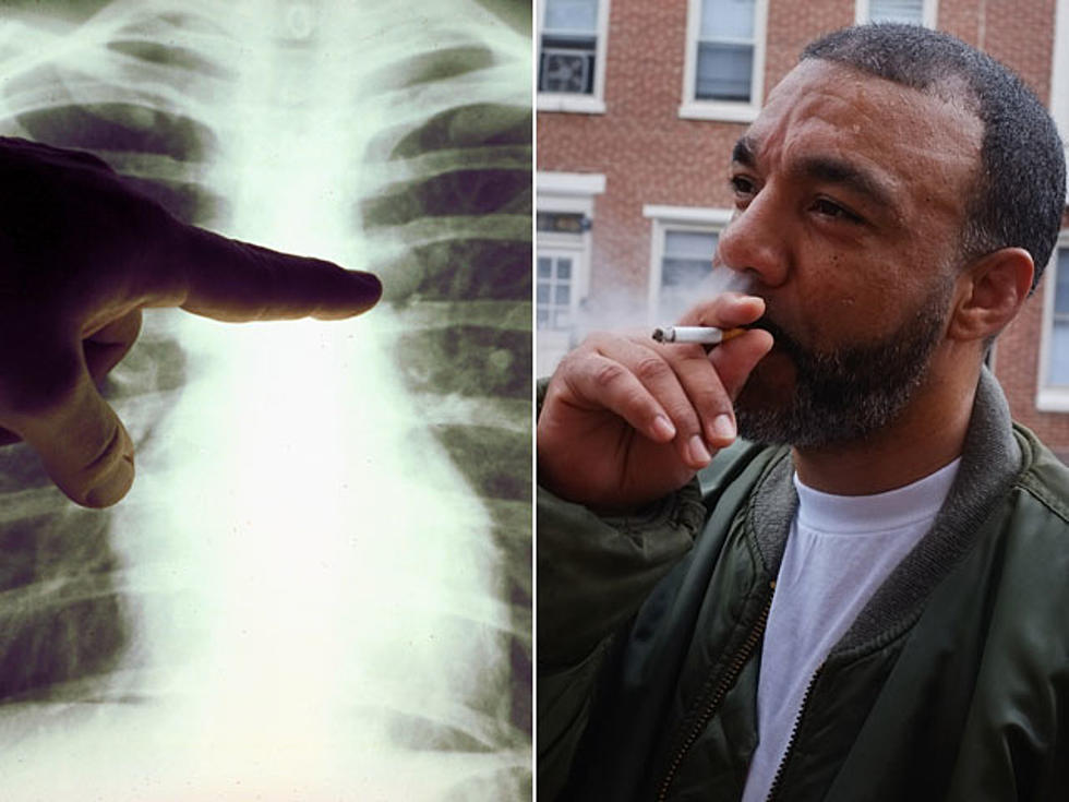 Lung Cancer Is Officially No Longer Just a ‘Smoker’s Disease’