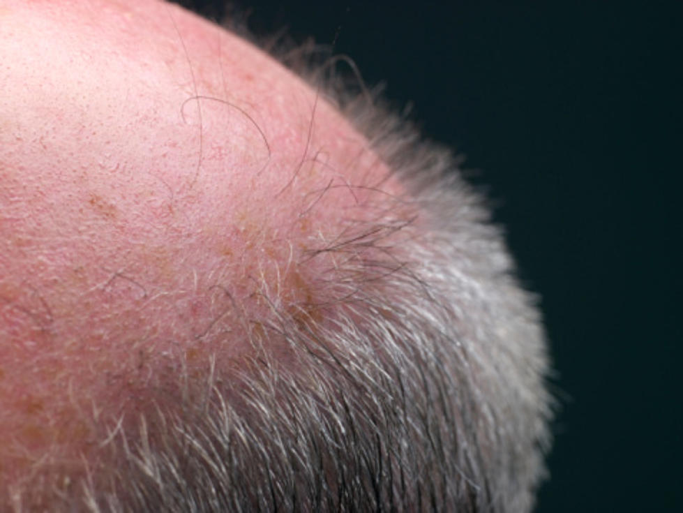 Can Leg Hair Really Be Used on Your Head?