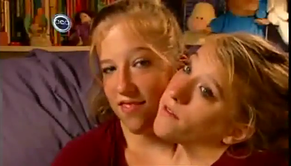 Two Heads are Better Than One, Conjoined Twins Share Experiences
