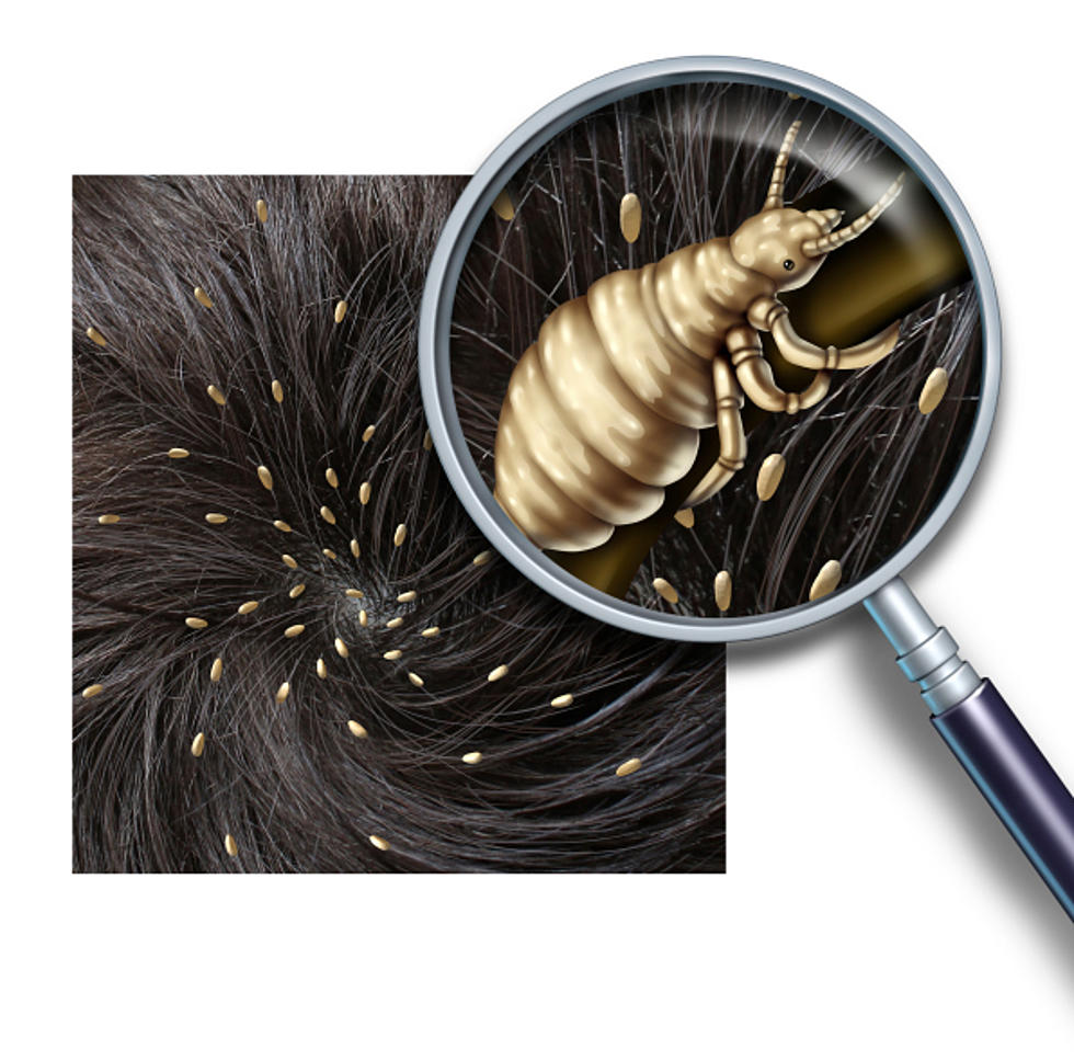 There’s Been a Big Increase in Head Lice, Here’s Why