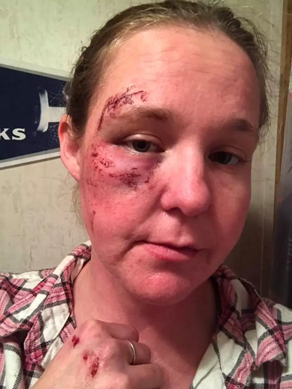 Yakima Woman Fights Off Attacker Asks For Your Help