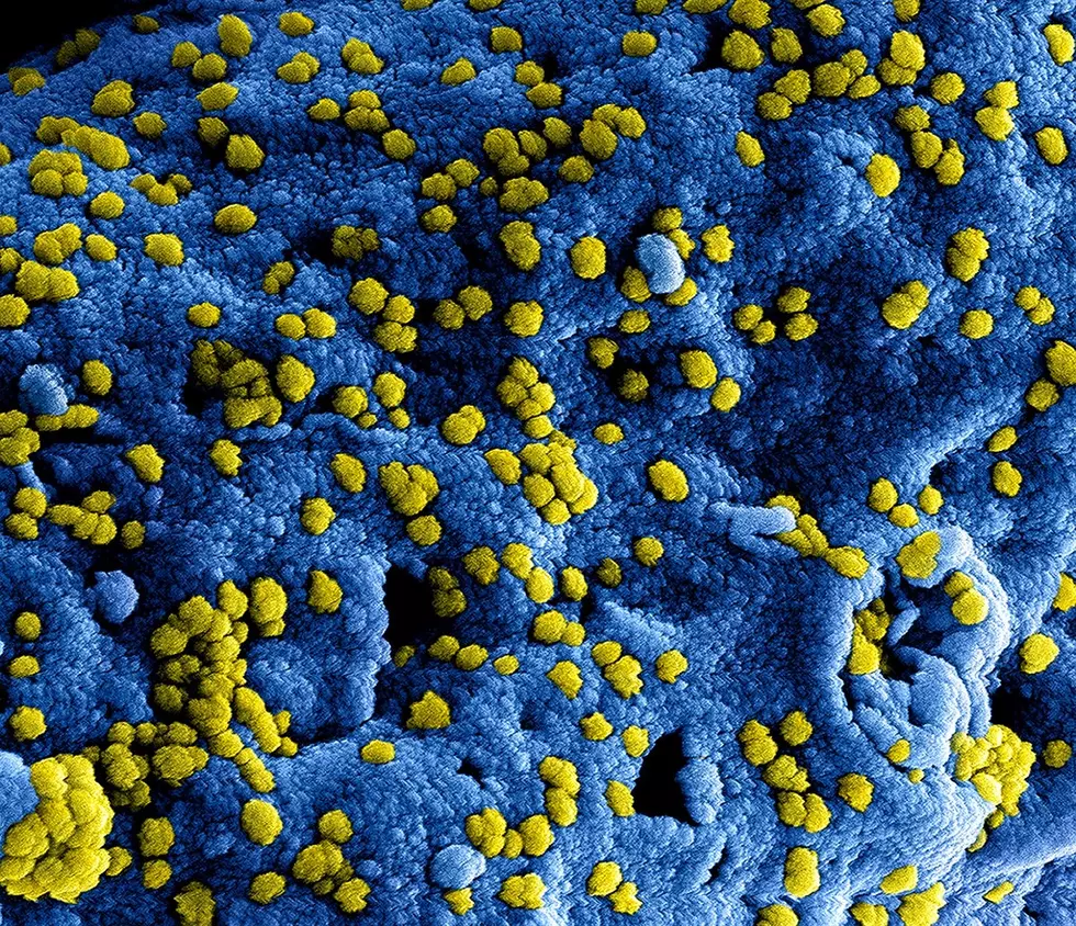 Benton-Franklin Counties Gets First Confirmed Case of Coronavirus