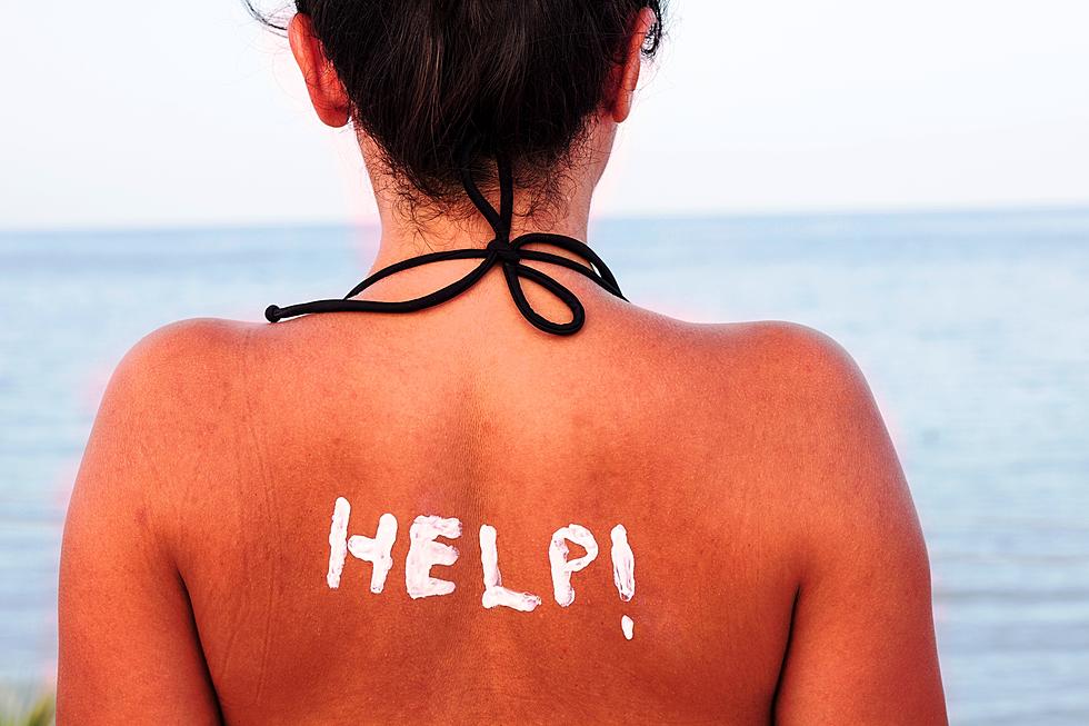 10 Natural Tips for Healing a Bad Sun Burn