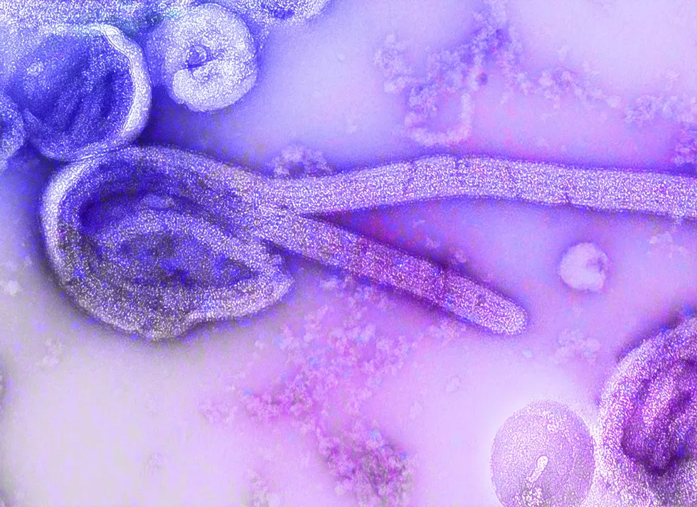 23 Washingtonians Watched for West African Ebola Virus Disease