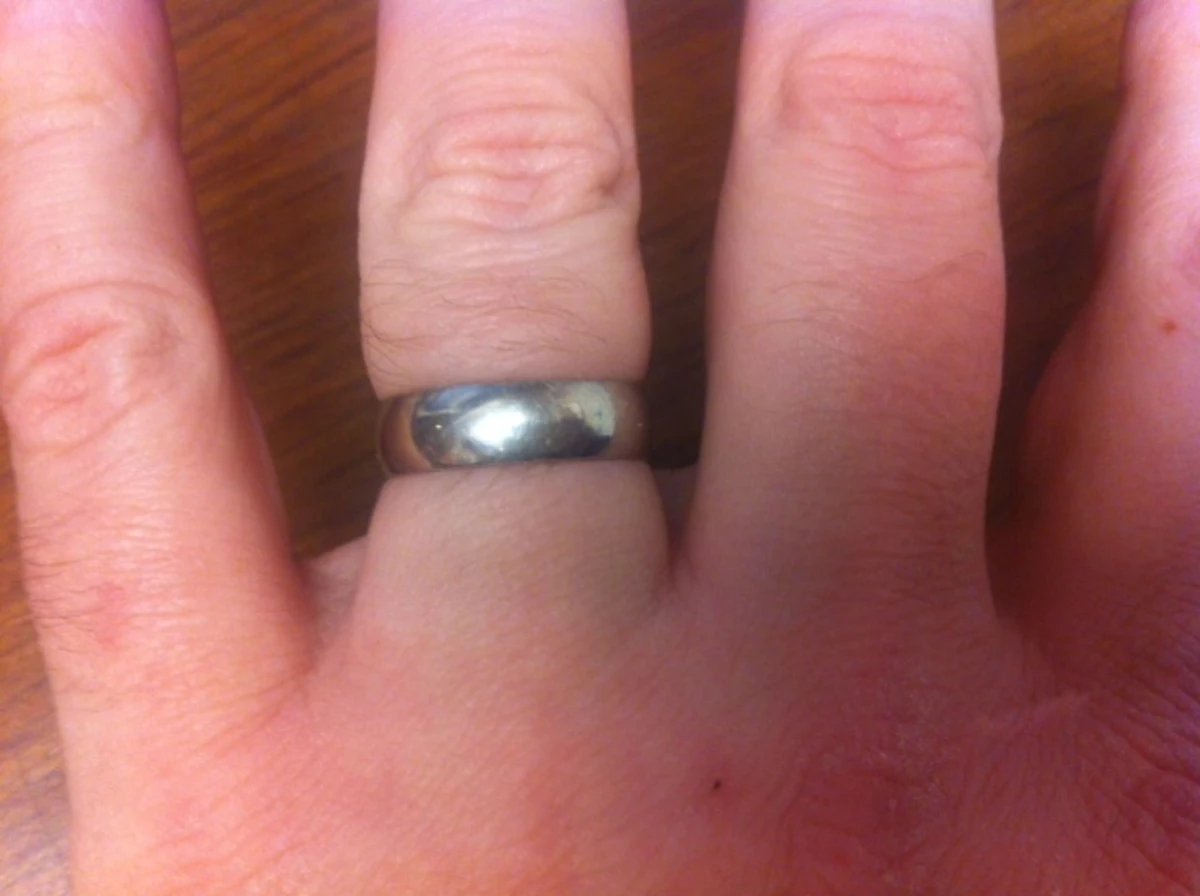 How To Remove a Ring from a Swollen Finger