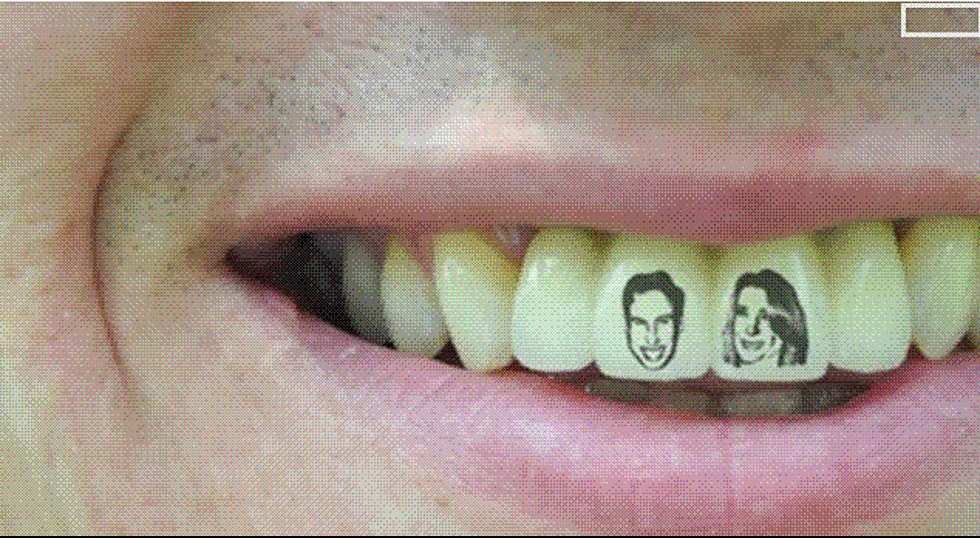 Say It Ain’t So: Teeth Tattoos Are Still A Thing