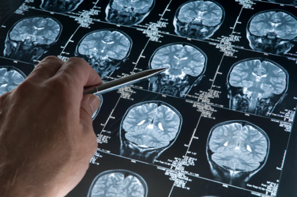 Study: Men at Higher Risk for Mild Memory Loss Than Women