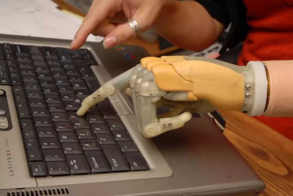 Man Creates Bionic Arms After Bomb Destroys His Hands