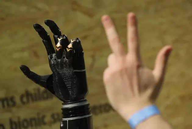 Bionic Arms &#038; The Future Is Here [VIDEO]