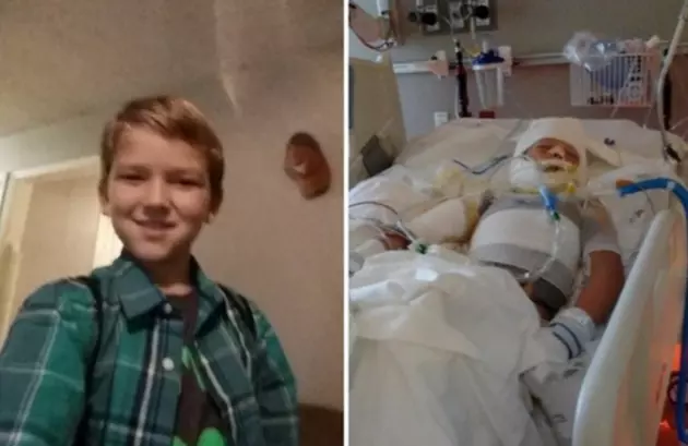 Texas Boy Fighting For His Life After He Was Set on Fire by Bullies