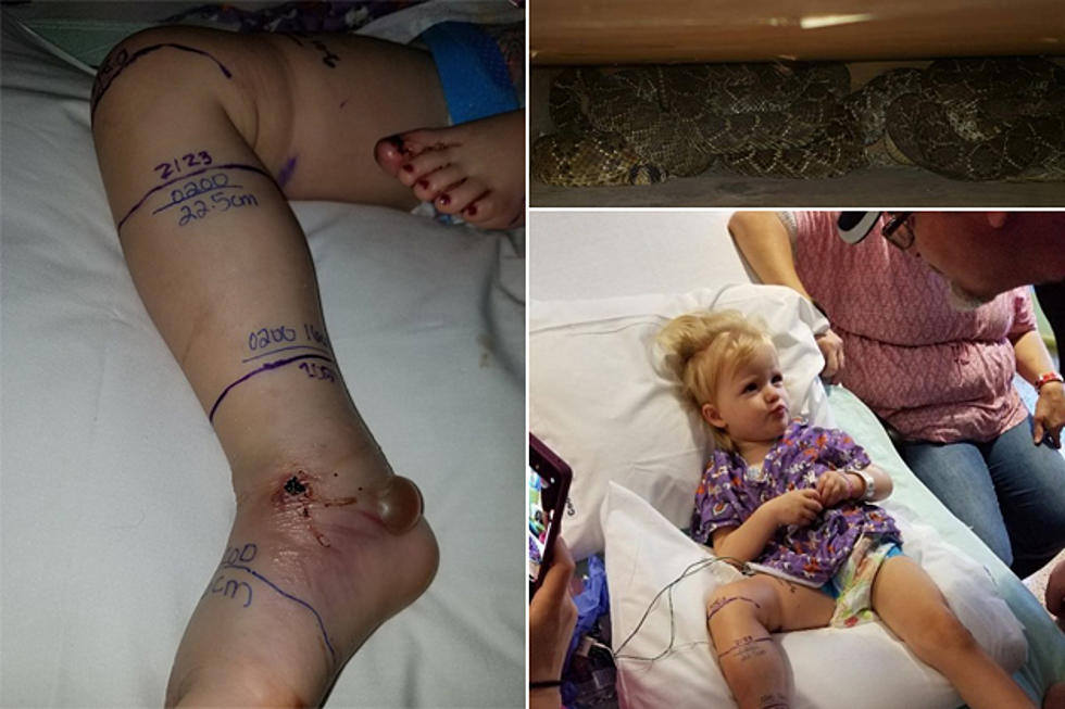 Texoma Toddler Bitten By Rattlesnake Recovering After Receiving 18 Vials of Antivenom
