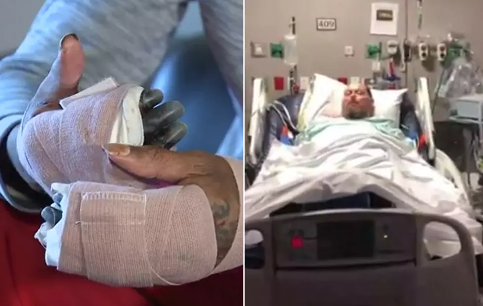 Two North Texas Men Lose Fingers and Feet Due to Flu Complications