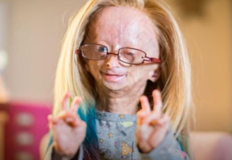 Adalia Rose TX Teen YouTuber with Rare Condition Has Passed Away