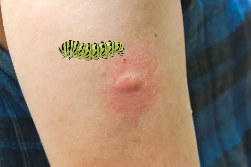 Why You Should Never Touch This Fuzzy Little Caterpillar in Louisiana