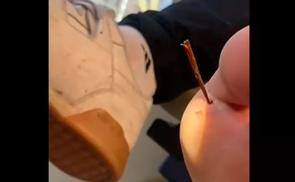 Watch GIGANTIC Splinter Popped From Foot, Oddly Satisfying But Not For The Faint of Heart