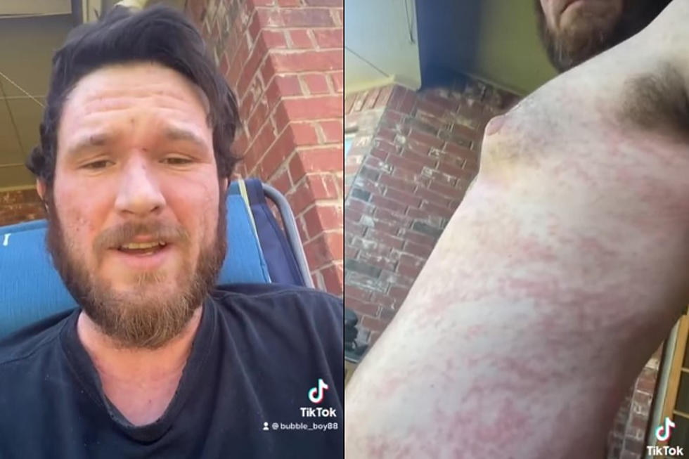 Lubbock Man Makes Heartfelt Plea to Community for Help With Awful Skin Condition