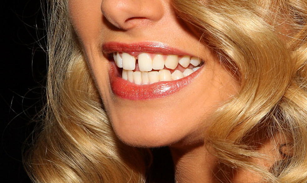Eight Surprising Things That Are Bad For Your Teeth