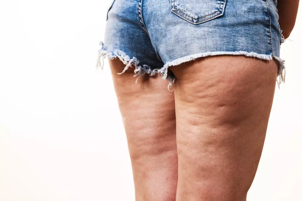 806 Health Tip: Good News If You Have Thicker Thighs