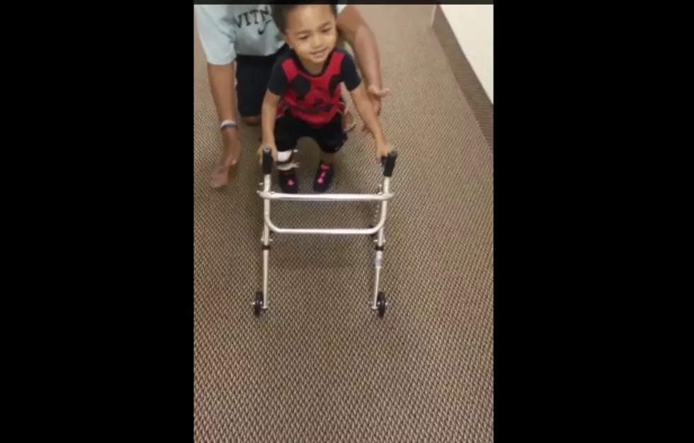 2-Year-Old Amputee Learns To Walk &#8212; &#8220;I Got This!&#8221; [VIDEO]