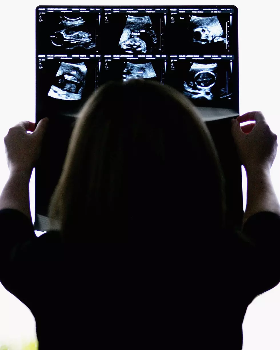 Baby Claps Along During Ultrasound 