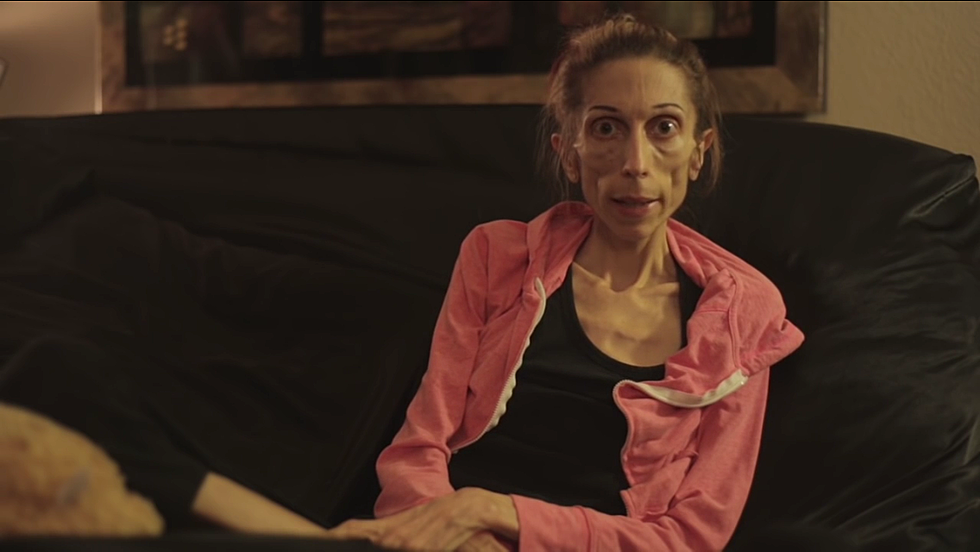 A 40-Pound Woman Battling Anorexia Released A Video Asking For Help [VIDEO]