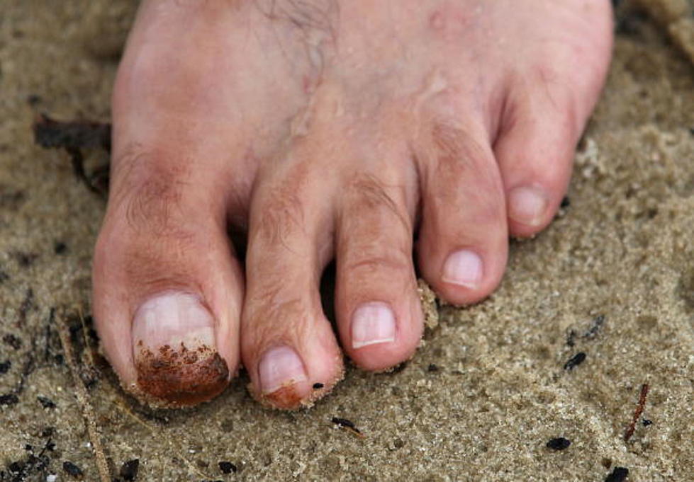Diabetic Man Wakes Up To Find Dog Ate 3 Of His Toes