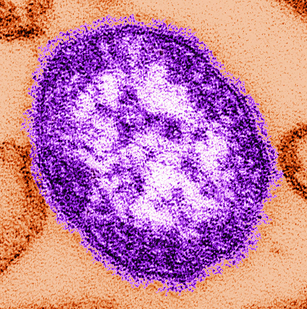 Minnesota Already has a Number of Confirmed Cases of Measles this Year