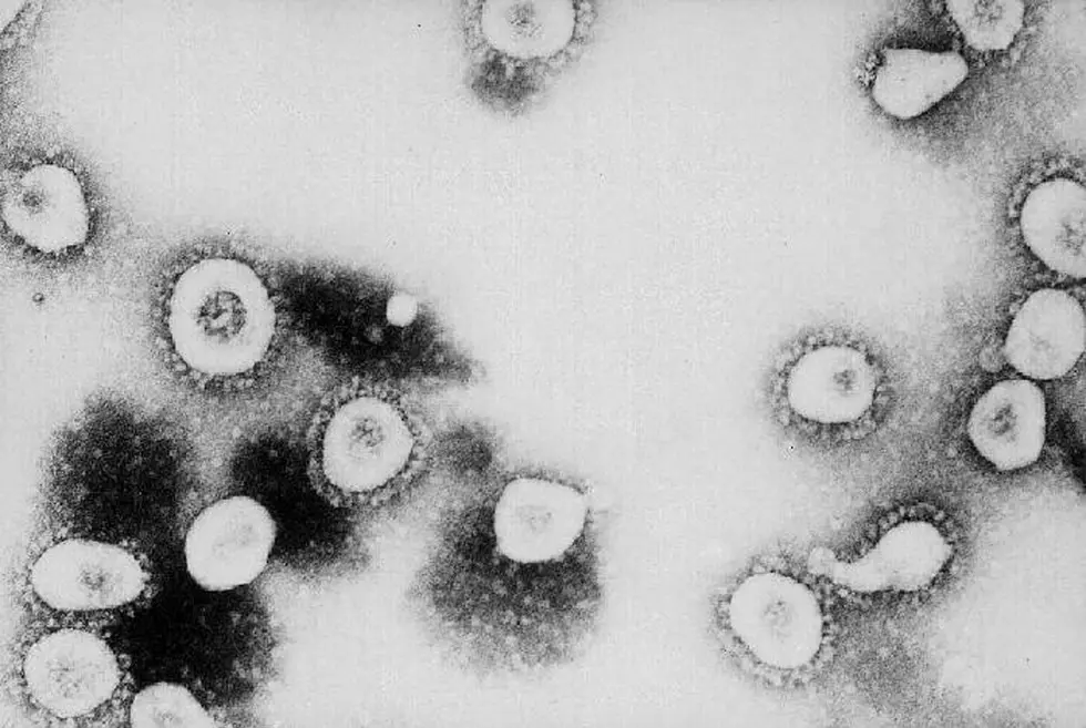 First Coronavirus Case Confirmed In Wisconsin