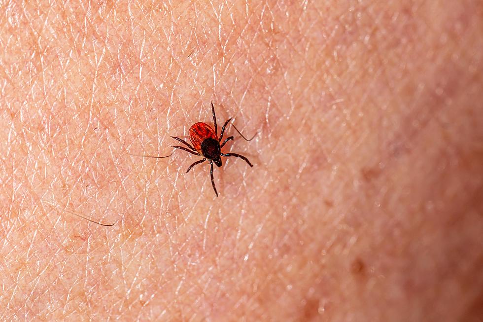 A Rare Tick-Borne Disease Is On The Rise, Spread By Deer Ticks In Minnesota + Wisconsin