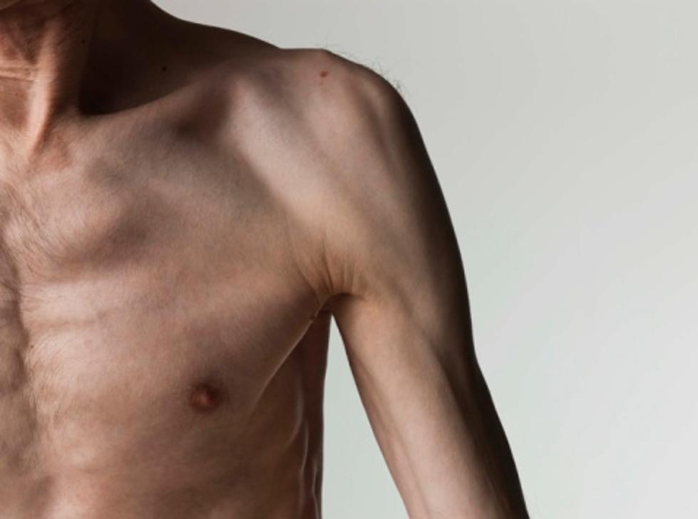 The New Face of Eating Disorders — Boys and Men