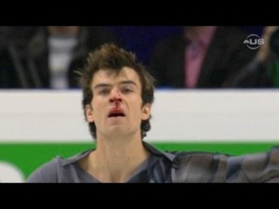 A Bloody Nose Wont Stop This Figure Skater![VIDEO]