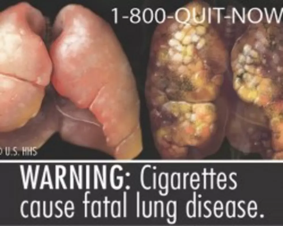 Tobacco Companies Sue to Block Graphic Warning Labels [VIDEO]
