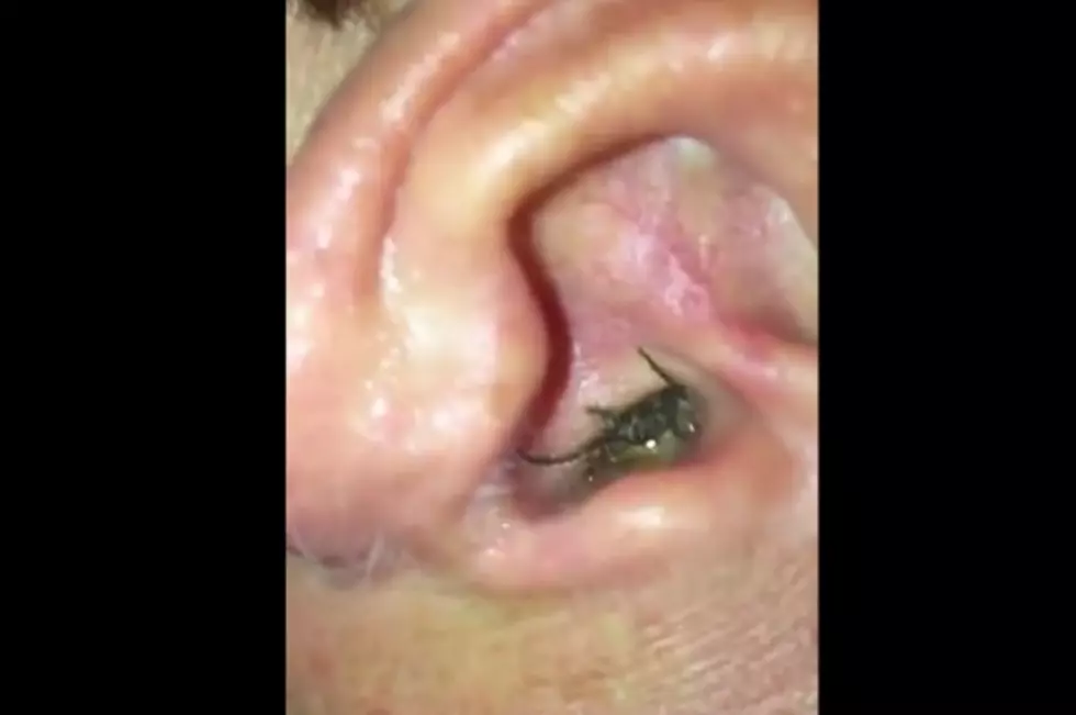 Man Finds Spider Living Inside His Ear