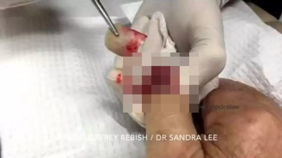 Try Not to Puke While Watching These Gross Videos [NSFW Videos]