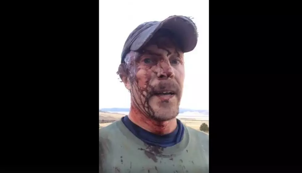 Montana Man Posts Gruesome Video After Being Attacked by Bear