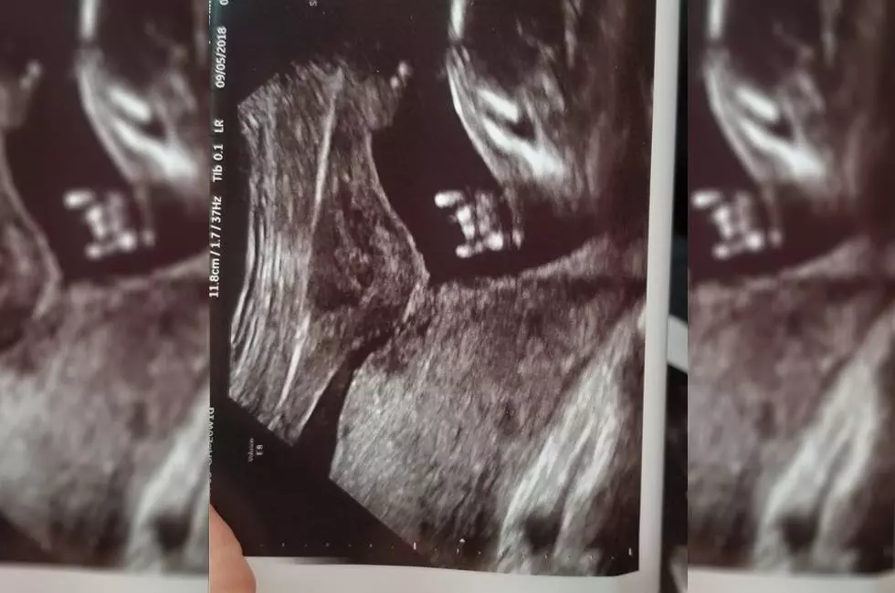 Texas Baby Throws Up Hook&#8217;em Horns Hand Sign While in the Womb