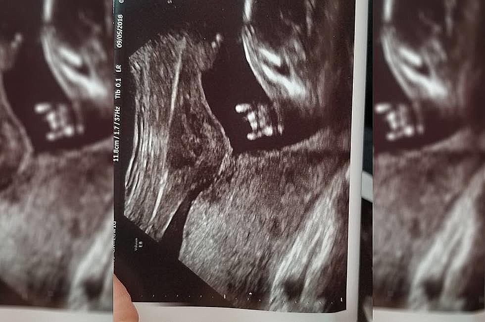 Texas Baby Throws Up The Hook’em Horns Hand Sign While in the Womb