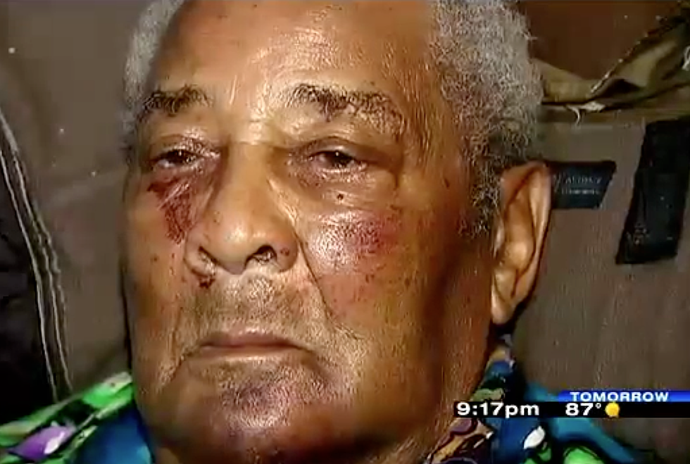 What the…? World War II Veteran Badly Beaten and Robbed by Teenage Thugs [POLL]
