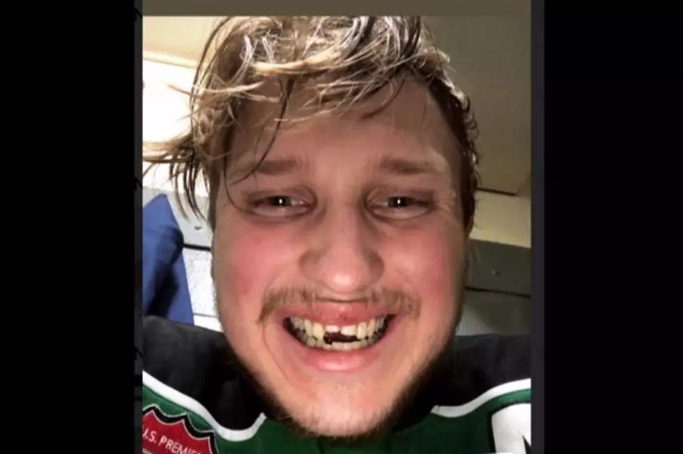 Former Mudbug Wants His 2 Front Teeth For Christmas