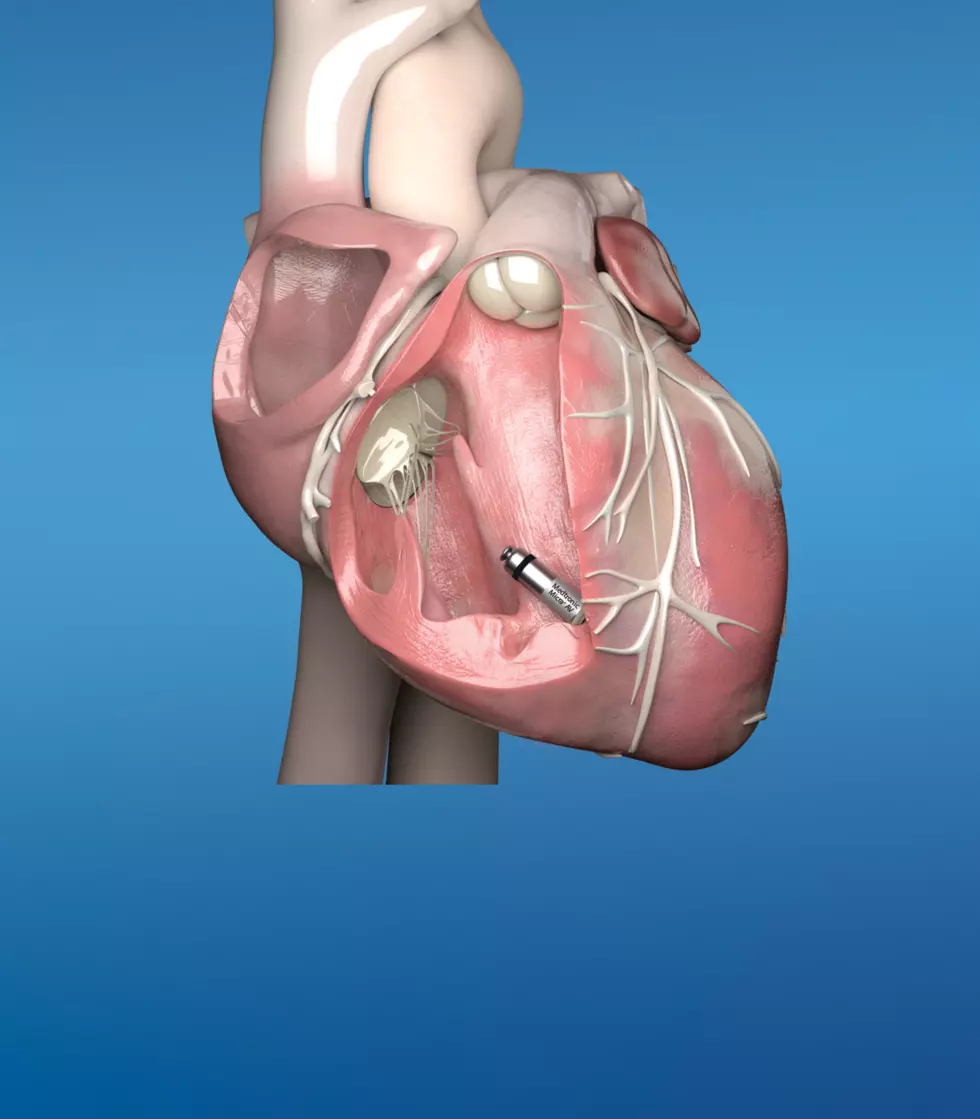 Willis-Knighton To Be First To Implant World&#8217;s Smallest Pacemaker
