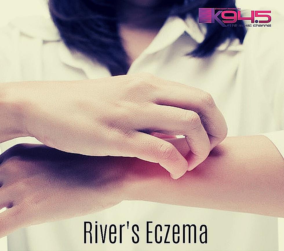 If Your Child Has Eczema, Watch This Video