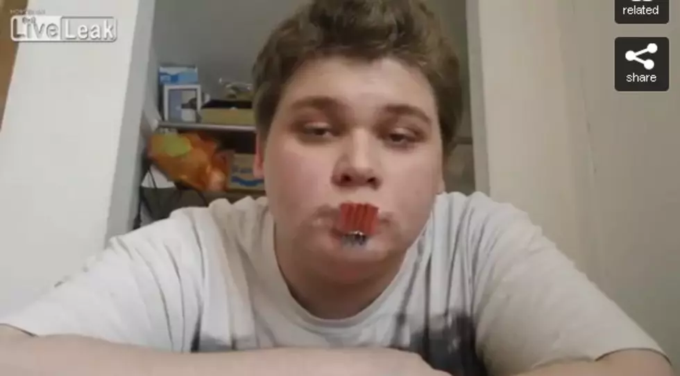 Moron Of The Day:  Dude Tapes Firecrackers To His Lips And Lights Them [VIDEO]