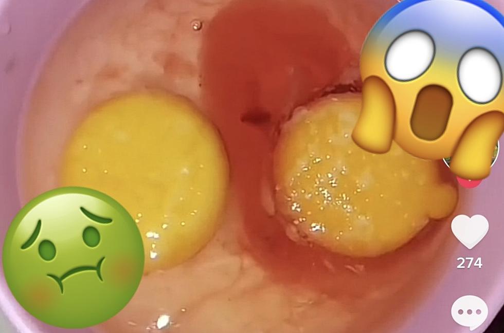 Lubbock Woman Shocked by Bloody Egg, Is It Safe to Eat?