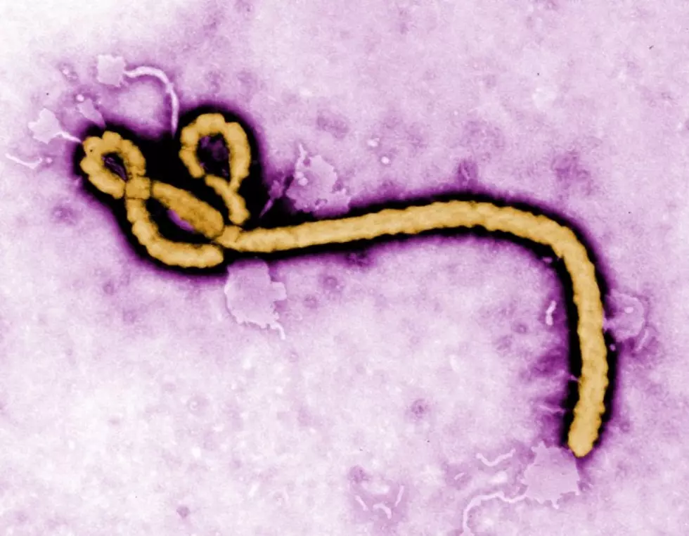How Concerned Are You About the Ebola Virus? [POLL]