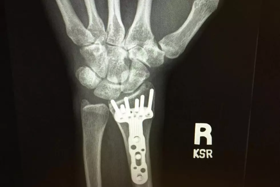 Carrie Underwood’s X-Ray Shows She’s Healed, But What Is That Thing?