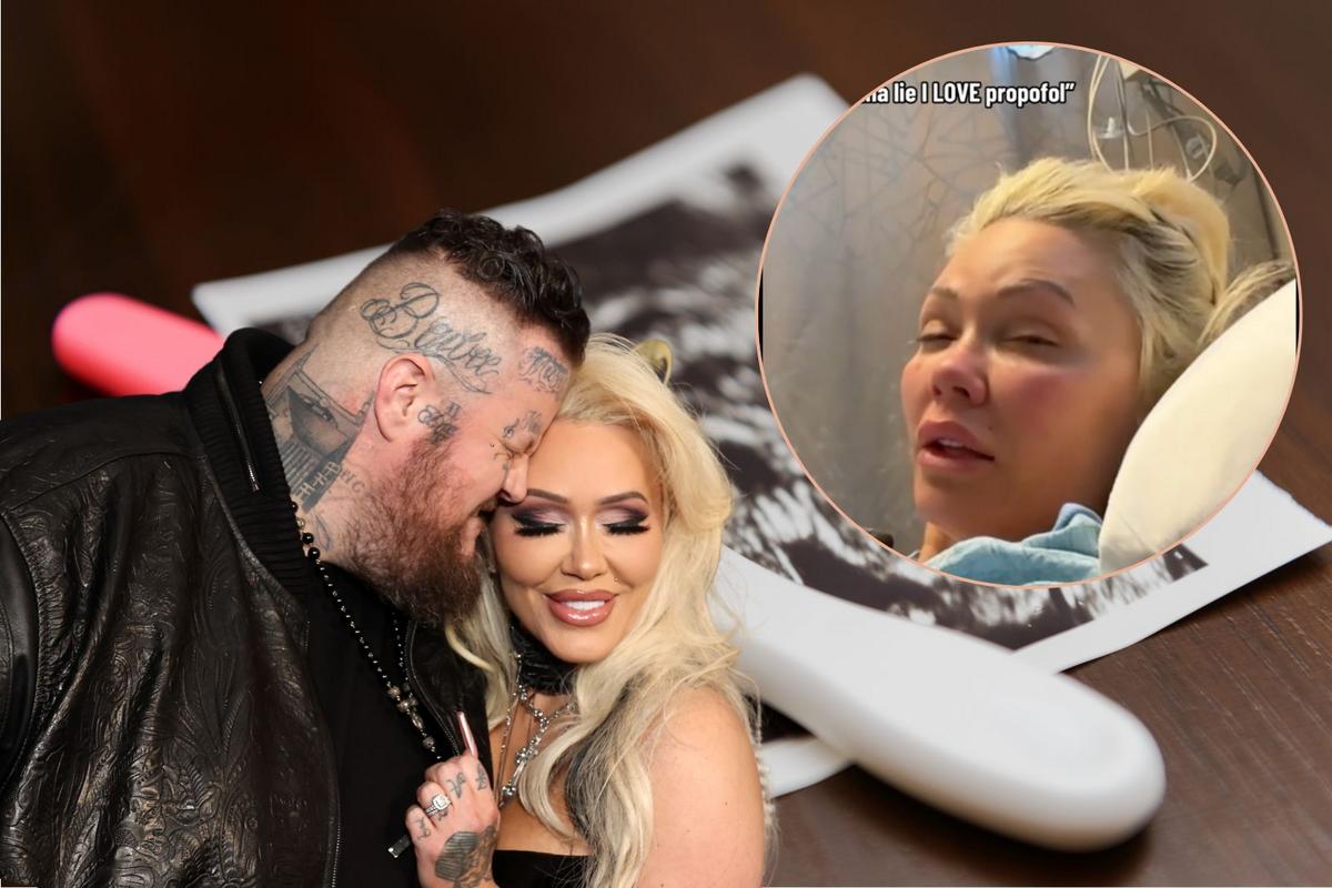 Bunnie Xo Was 'High as Hell' After IVF Surgery: 'Making Babies'
